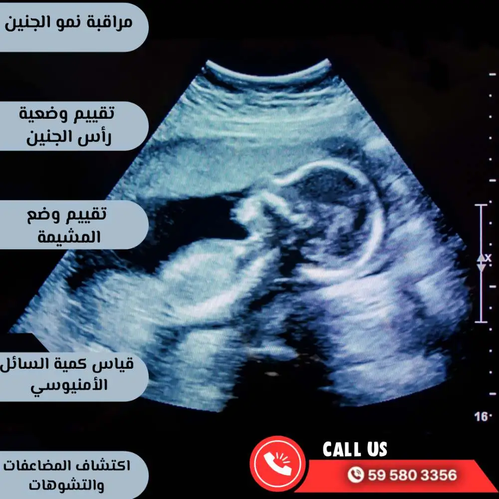 أهمية السونار في الشهر التاسع